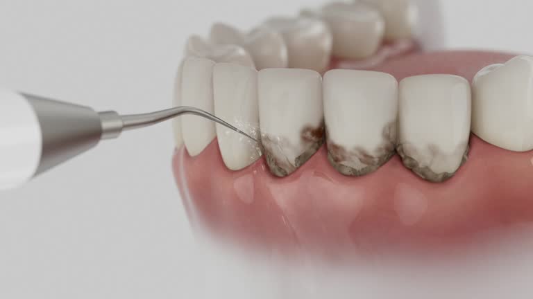 Trusted Emergency Dentist service in Piedmont, CA - Dentist Open Now